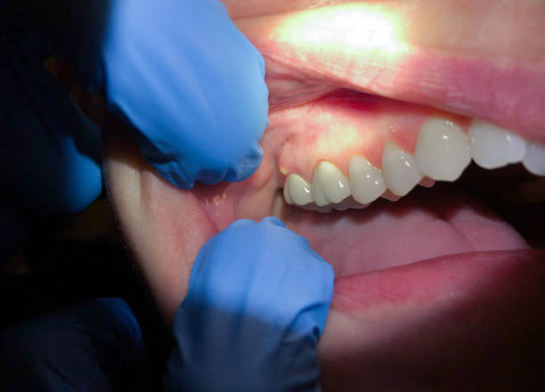 Best Emergency Cosmetic Dentistry (e.g., broken veneers) in Neptune City, NJ