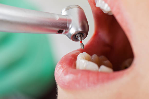 Best Emergency Treatment for Oral Infections in Neptune City, NJ